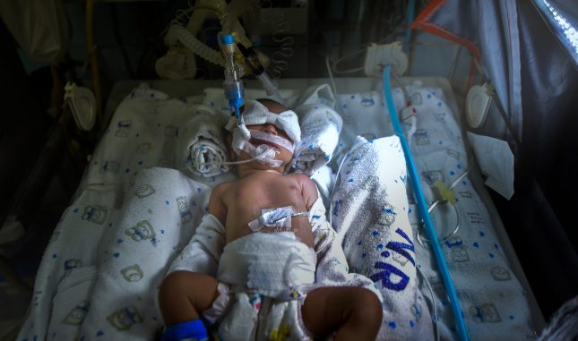 תינוק שנולד חולה. צואת התינוקות יכולה להעיד על תוצא לידה שלילי