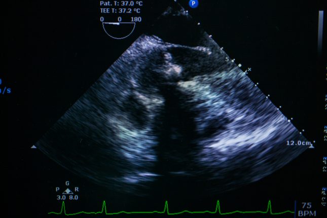 אקו-לב.-אילוסטרציה