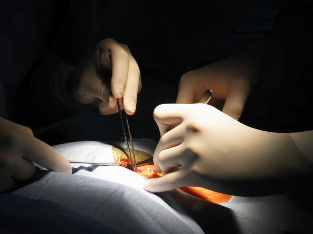 השתלת-כליה.-אילוסטרציה