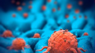 תאי סרטן. אילוסטרציה