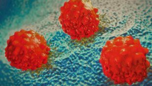 תאים-סרטניים.-אילוסטרציה