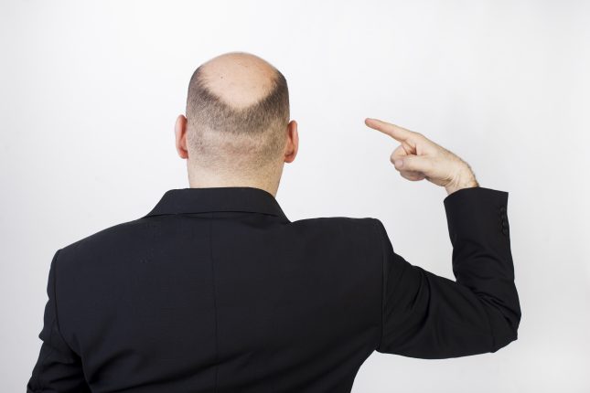 גבר קירח. שימוש ממושך במעכבי 5-אלפא רדוקטאז עלול לגרום לתופעות לוואי