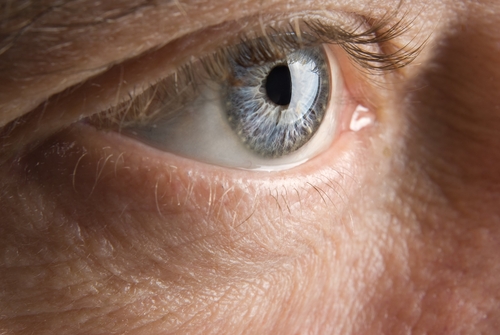 עיניים דומעות (אילוסטרציה)