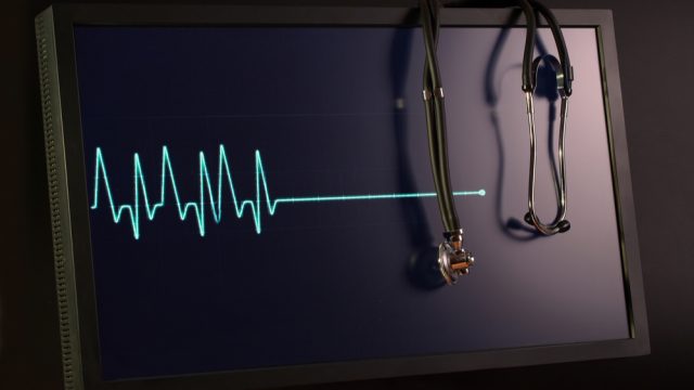 אי ספיקת לב (אילוסטרציה)