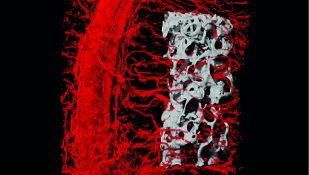 סריקה תלת-ממדית הממחישה את חדירת כלי הדם אל תוך העצם המושתלת בתוך מתלה הרקמה. צילום: דוברות הטכניון