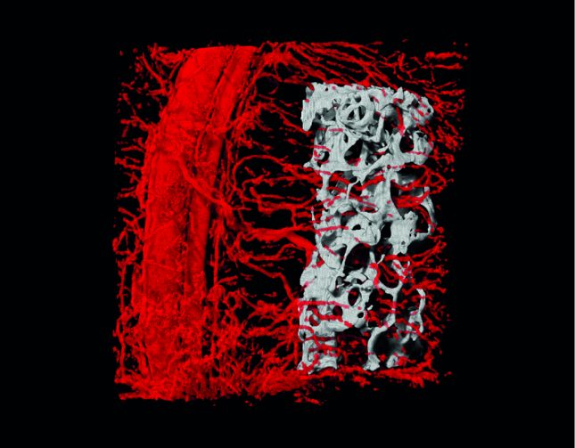 סריקה תלת-ממדית הממחישה את חדירת כלי הדם אל תוך העצם המושתלת בתוך מתלה הרקמה. צילום: דוברות הטכניון