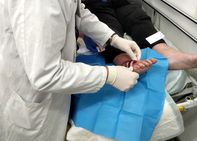 טיפול ביולוגי לפצעים כרוניים. צילום: בית החולים הלל יפה