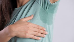 הזעת יתר, בית שחי. אילוסטרציה