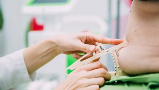 עודף משקל, מדידת שומן גוף. אילוסטרציה