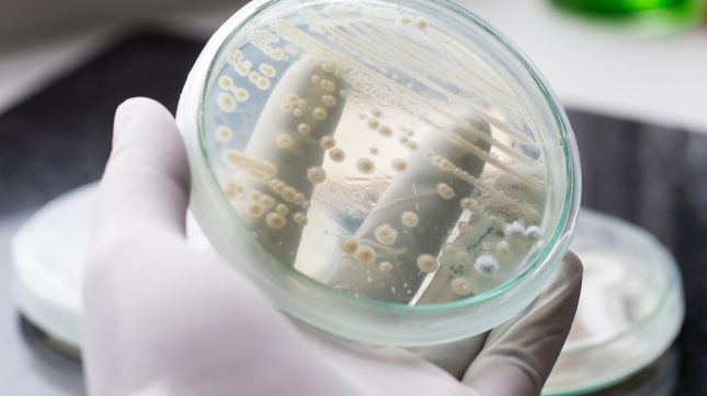 שמרים. אילוסטרציה