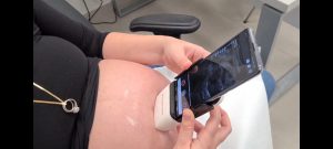 אולטרסאונד מהספה בבית או מהכיסא במשרד. צילום: שיבא BEYOND 