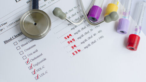 כולסטרול. אילוסטרציה