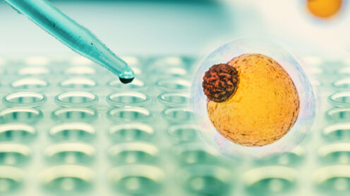 כולסטרול (אילוסטרציה)