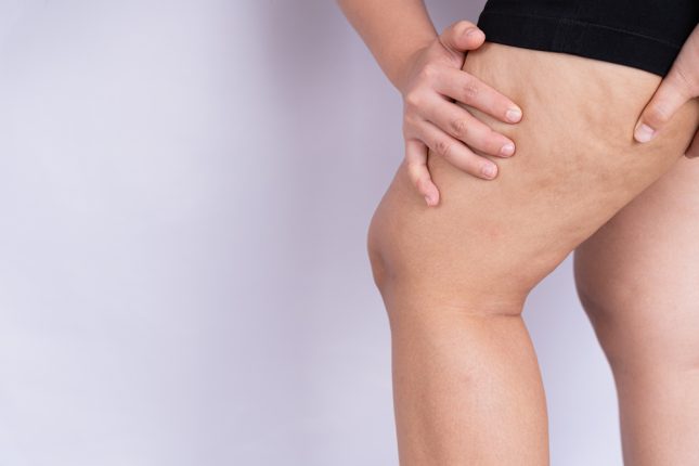 רקמת שומן תת עורי. אילוסטרציה