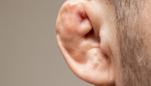 אוזן כרובית. אילוסטרציה