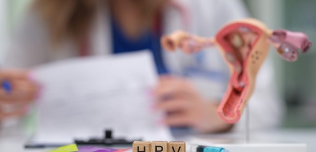 סרטן צוואר הרחם, HPV, פפילומה. אילוסטרציה