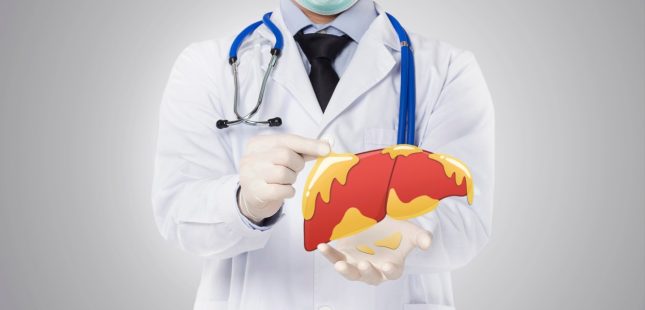 כבד שומני (אילוסטרציה)