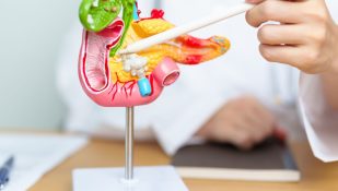 לבלב. אילוסטרציה