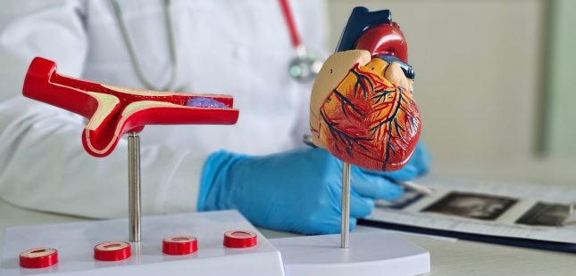 מחלות לב וכלי דם, עורקים. אילוסטרציה