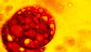 שומנים בדם. אילוסטרציה