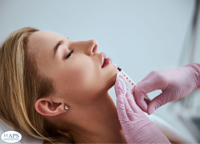 הזרקת חומצה היאלורונית - תמונת אילוסטרציה - ארגון המנתחים הפלסטים אסתטיים.