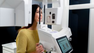 סריקת תלת-ממד . אילוסטרציב