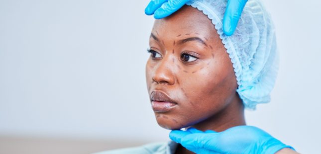 ניתוח פלסטי. אילוסטרציה